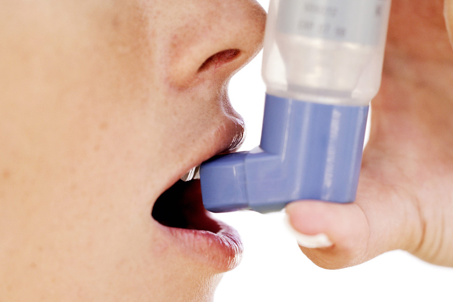 Cirugía para la diabetes