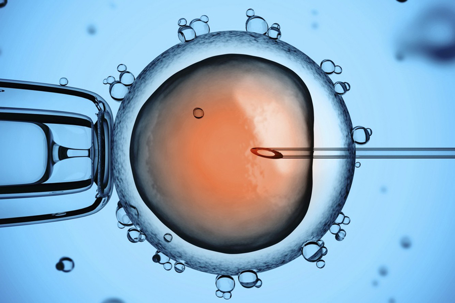 ¿Qué es el síndrome de ovario poliquístico? 