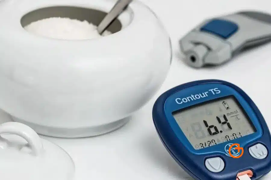 Cirugia de la obesidad aparición de hipoglucemia en el bypass gástrico