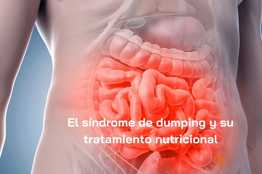 sindrome dumping