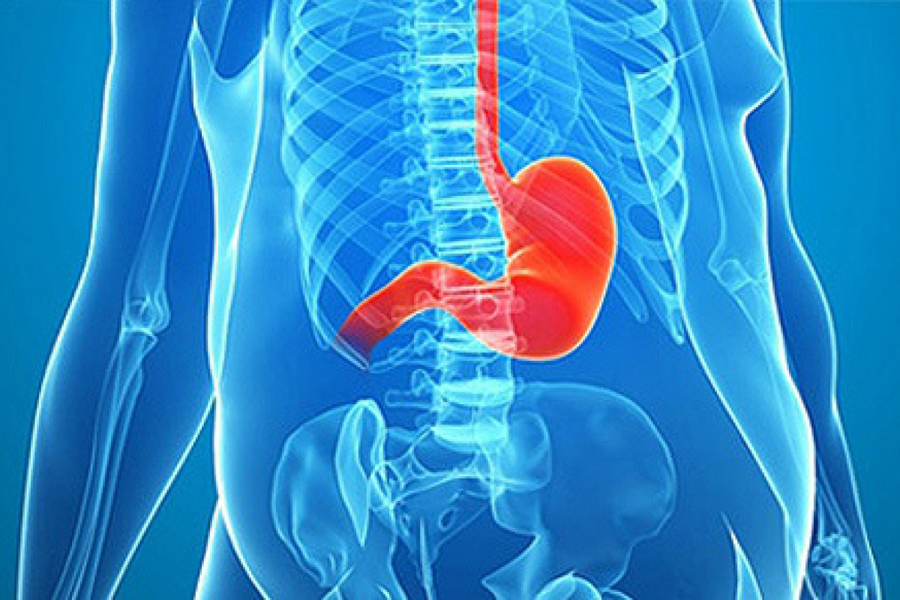 Preparación previa a la cirugía de obesidad 