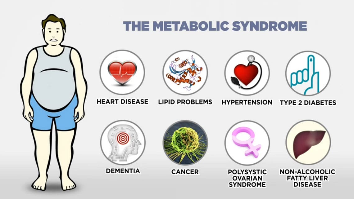 sindrome metabólico