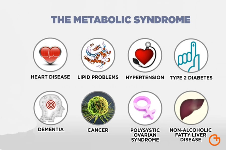 sindrome metabólico y su relación con la obesidad